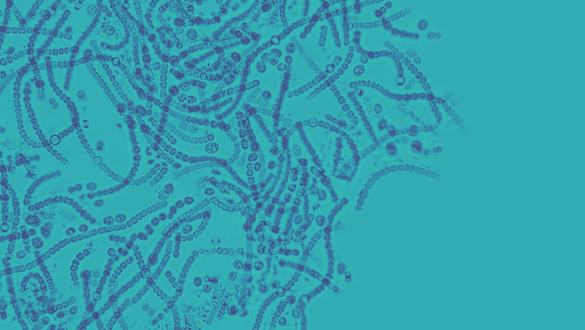 An image of a variety of bacteria in dark blue against an aquamarine background.