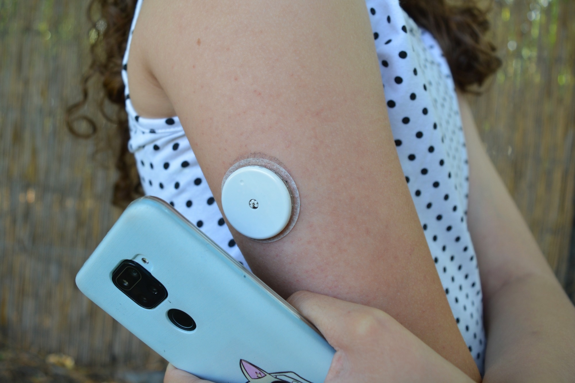 Girl use application on mobile phone to read sensor for continuous glucose monitoring on arm.