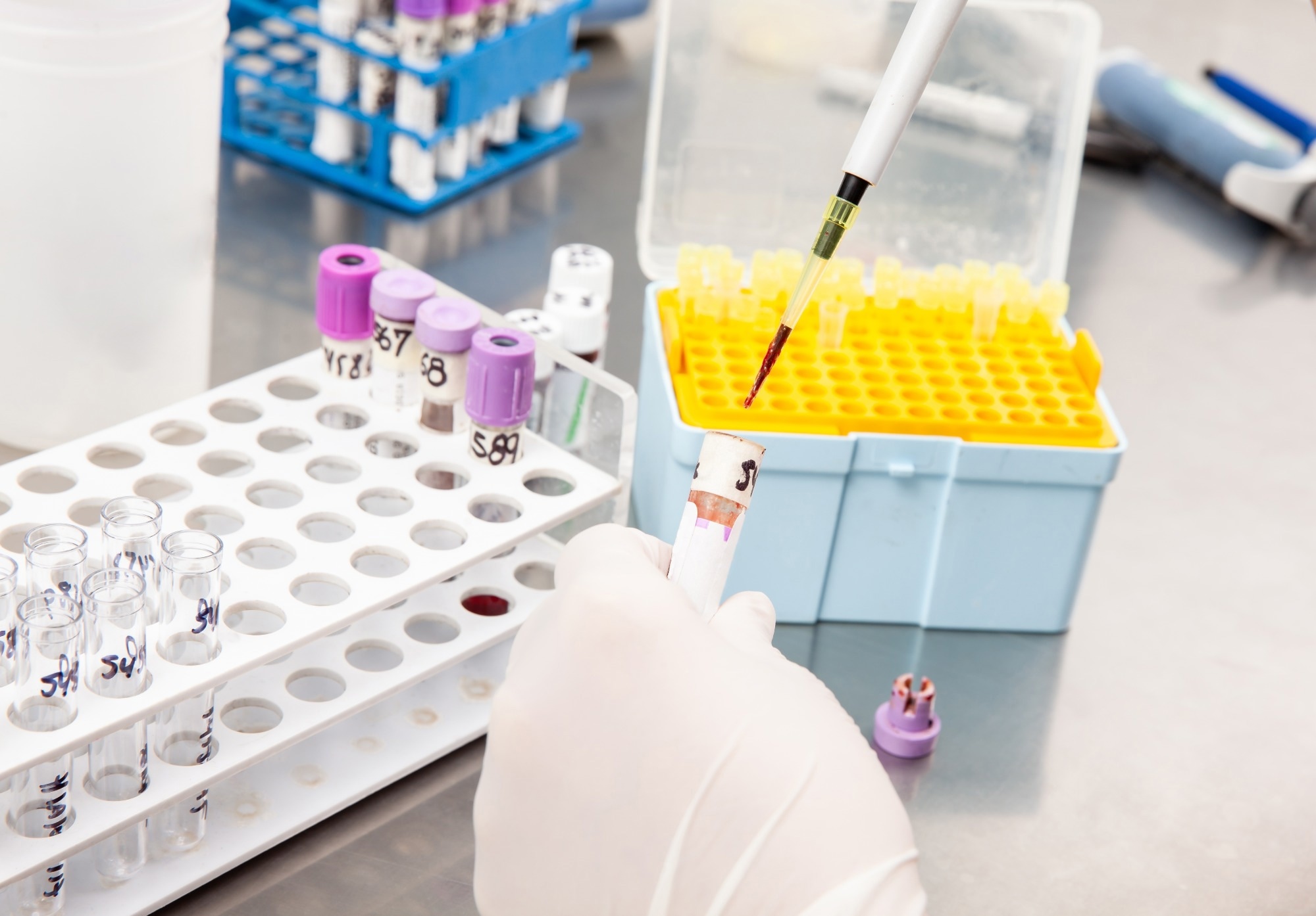 A researcher prepares a sample for processing with a micropipette.