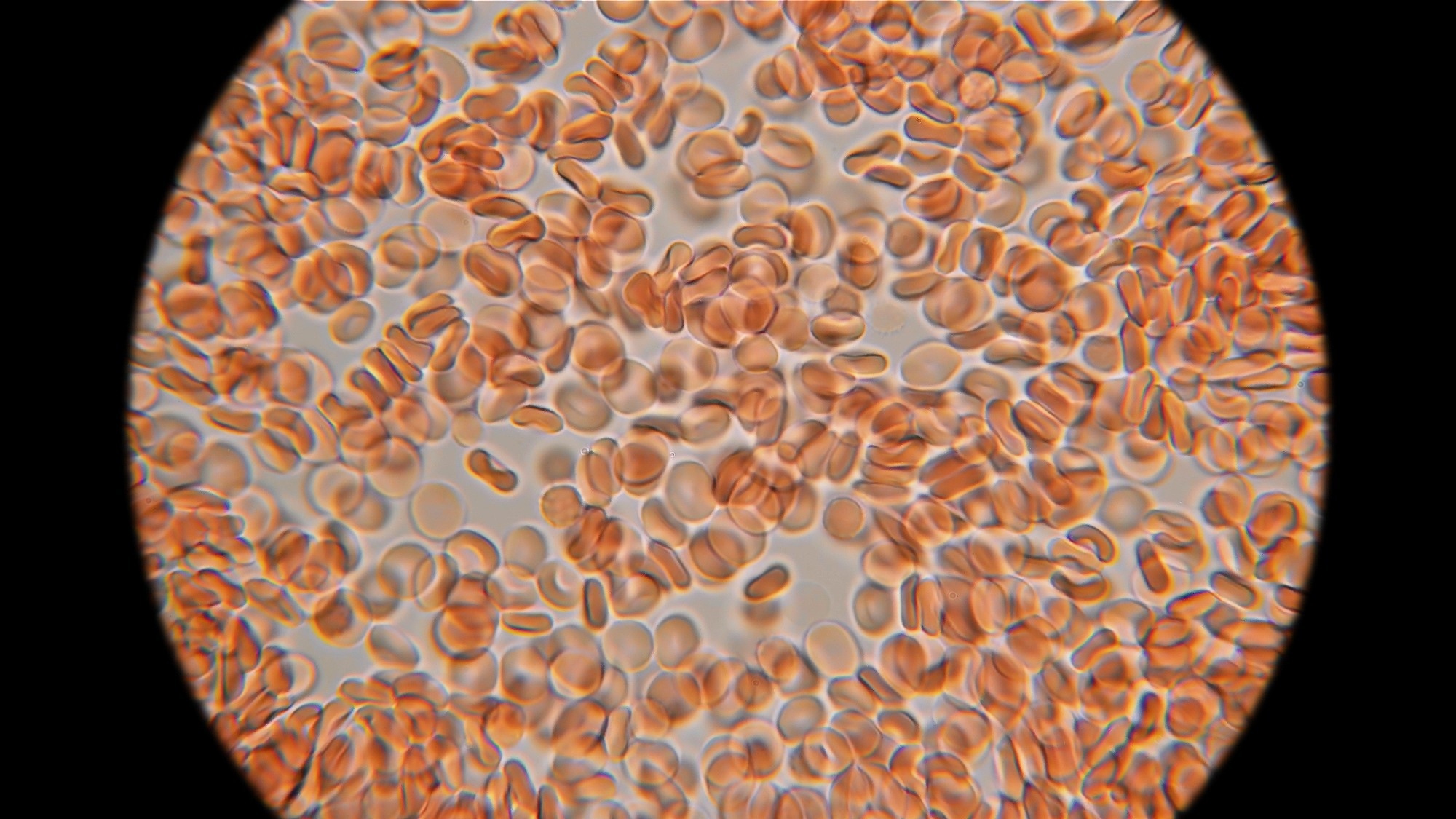 FEOX Biosensor Tracks Intracellular Iron in Stem Cell Differentiation