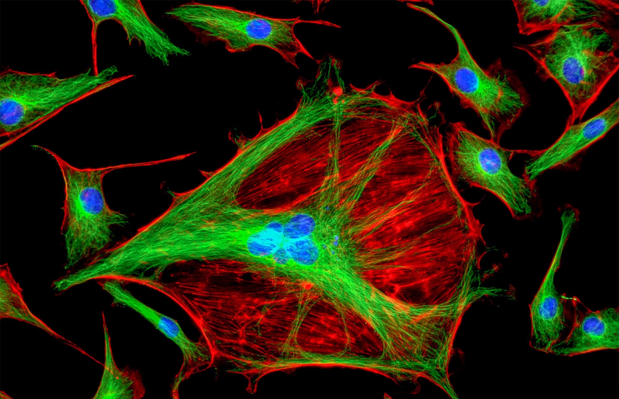 Bovine cells bioimaging to illustrate lit up self sufficient amino acids