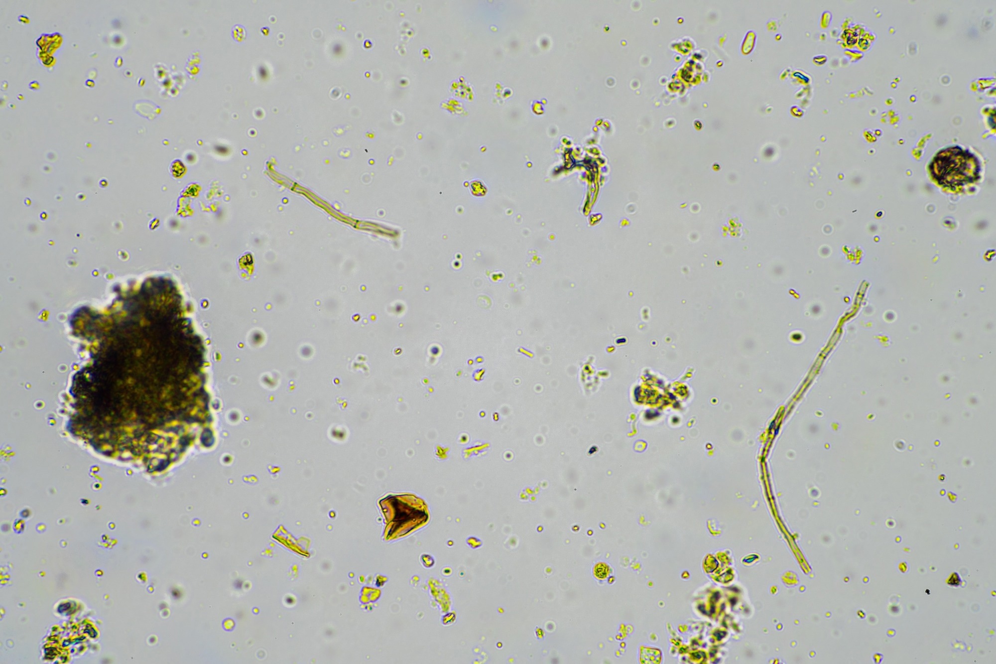 soil microorganisms in a soil life sample from a sustainable agriculture farm. living food web or bacteria fungi and protozoa in australia