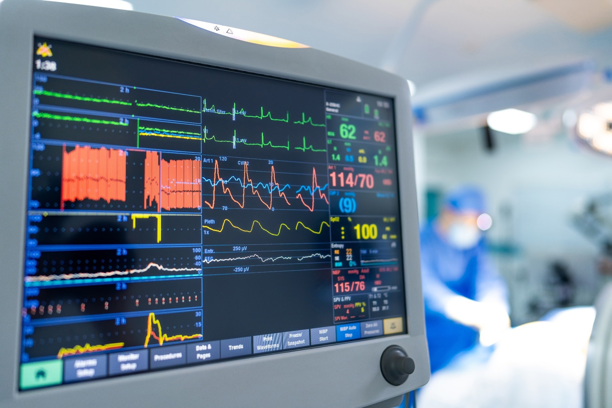 A vital signs monitor displays real-time health data while a surgical procedure is underway in an operating room.