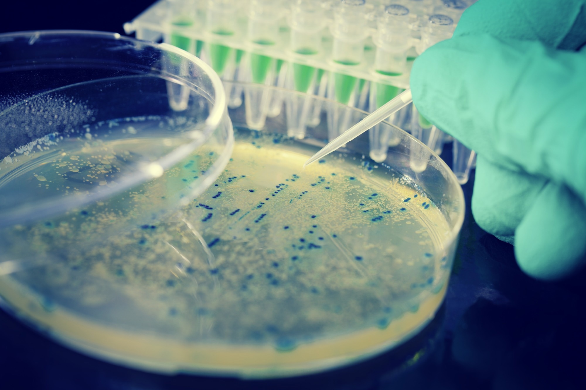 Carbon Dot Biosensor Detects E. coli DNA
