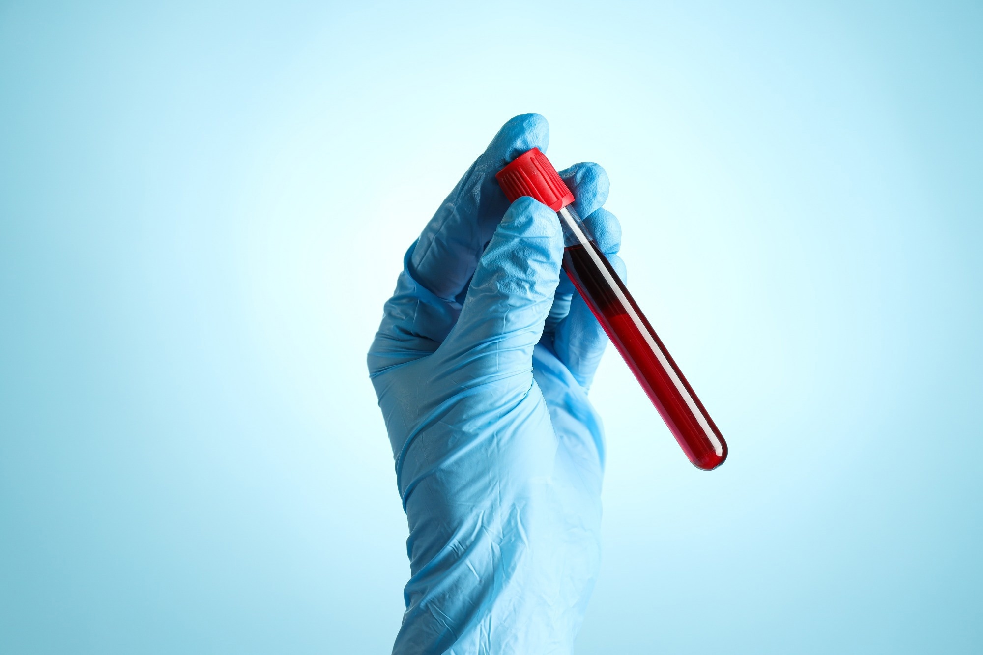 A medical-gloved hand holding a vial with a blood sample