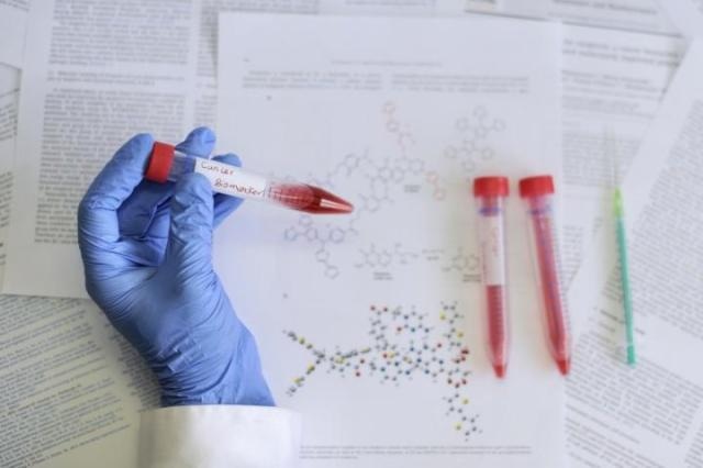 Newly Developed Chemical Sensors Could Provide Early Diagnosis of Cancer