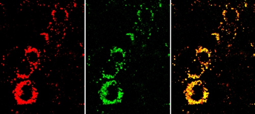 Novel Nanosensors Pave Way to Test Effectiveness of Chemotherapy Agents