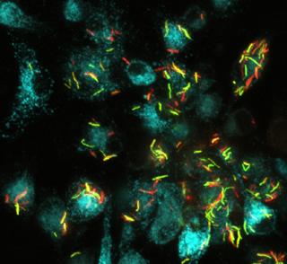 Novel Synthetic Biosensor Glows in Response to Conditions that Mimic TB Infection