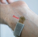 Researchers Develop Ultrathin, Skin-Conforming Sensor for Precise Monitoring of Blood Flow