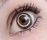 Contact Lens with Built-in Sensor Helps Determine Disease Progression in Glaucoma Patients