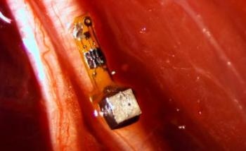 New Implantable, Wireless Sensors May Help Monitor Internal Nerves, Muscles and Organs in Real Time