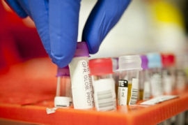 Researchers Develop New Sensor to Accelerate Blood Test Analysis
