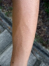 New Sensor Technology Could Stimulate Sweat Glands on Isolated Patch of Skin