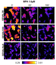 Unique Fluorescent Sensors Could Effectively Treat Solid-Tumor Cancers