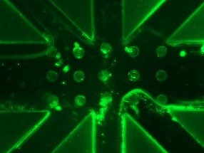 Innovative Microsensor for Customizing Kidney Dialysis