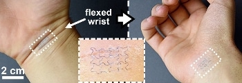 Water-resistant Stickers Could Be Used to Monitor Patient Health 