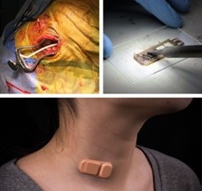 New Wearable Shunt Monitor Offers New Hope to Hydrocephalus Patients