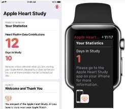 Researchers Perform Clinical Study to Determine Utility of Wearable Technology in Atrial Fibrillation Diagnosis