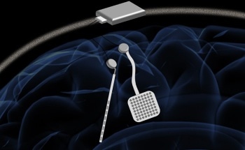 Wireless and Autonomous Neurostimulator Shows Promise for Treating Neurological Disorders