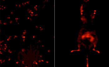 New Biosensors for the Detection and Study of Tumor Evolution