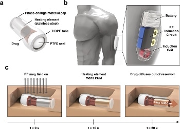 Wearable Sensor can Prevent Opioid Overdose