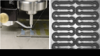 Stretchable Wireless Sensor Designed to Track Healing of Cerebral Aneurysms