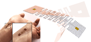New Kirigami-Based Method to Develop Damage-Resistant Wearable Sensors