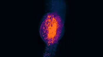 Chromacity and Scientifica join Forces on Laser Microscopy