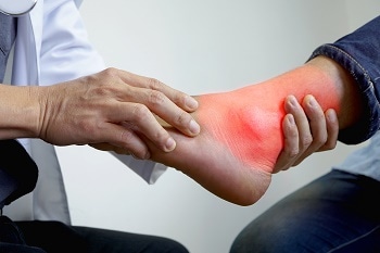 Wearable Sensor Used to Detect Gout