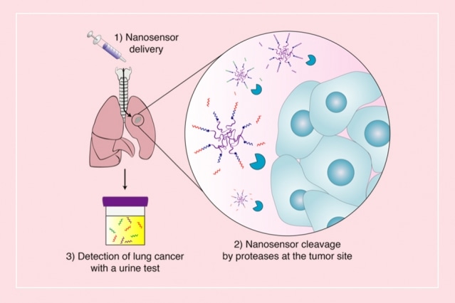 New Sensors Could Offer Early Detection Of Lung Tumors