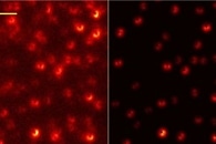 Amphiphilic AIE-Active Sensor to Overcome Traditional Bottleneck of AIE Bioimaging