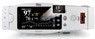 Masimo PVI Predicts Hemodynamic Effects of PEEP in Ventilated Patients