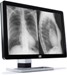 SmoothGray Technology-Enabled Monitors from Barco