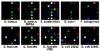 Researchers Use Sensor Array to Detect Infectious Bacteria