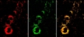 Novel Nanosensors Pave Way to Test Effectiveness of Chemotherapy Agents