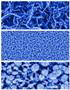 Innovative Biosensor Takes Diabetes Testing to a New Level