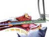 ESCATEC Designs TwinStream Superimposed High Frequency Jet Ventilator