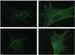 Study Provides New Insights into Nutrient-Sensing Enzymes