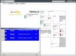 Aker Eye/Vision Source Uses Versus Technology’s RTLS to Improve Patient Flow