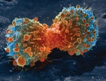 Molecular Sensor Non-Invasively Detects Lactate in Individual Cells