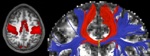 New Algorithms to Better Decipher Medical Sensor Data