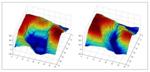 Video Analysis Algorithm Non-Invasively Estimates Driver’s Fatigue Based on Eyelid Closure