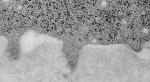 New Insights into Early Molecular Events Involved in Metastasis Using Novel Biosensor