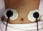 Non-Invasive Biosensor Could Help Diagnose Irritable Bowel Syndrome and Inflammatory Bowel Disease