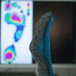 New Pressure-Monitoring Stockings to Help Diabetics Protect Against Wounds