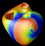 NSF Awards Funds for Cyberheart Project to Accelerate Medical-Device Development