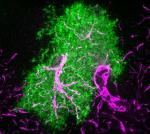 RI-MUHC Awarded Nearly $1.5 Million Grant to Develop Glutamate Biosensor Platform for Brain Diseases