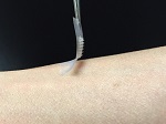 New Smart Insulin Patch May Replace Injections for Diabetics