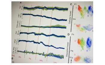 Scientists Develop New Wearable Device to Assess Blood Loss Caused by Hemorrhage