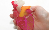 A Heart-Breast Cancer-on-a-Chip Platform for Monitoring Cardiotoxicity